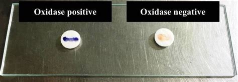 what does oxidase positive mean|OXIDASE TEST .